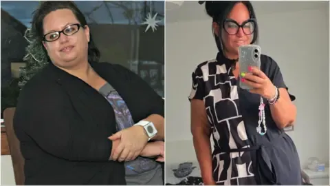 Many Dropped Weight Using Shots – Then Came the Loose Skin