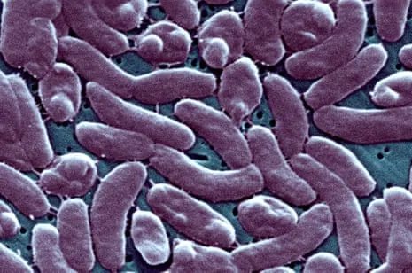 Louisiana Reports Five Fatalities from Necrotizing Bacteria in Coastal Waters